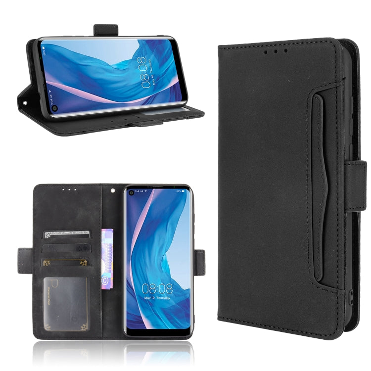 For Ulefone Note 11P Skin Feel Calf Pattern Horizontal Flip Leather Case with Holder & Card Slots & Photo Frame(Black) - Ulefone Cases by PMC Jewellery | Online Shopping South Africa | PMC Jewellery | Buy Now Pay Later Mobicred