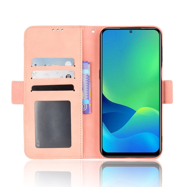 For Ulefone Note 13P Skin Feel Calf Pattern Leather Phone Case(Pink) - Ulefone Cases by PMC Jewellery | Online Shopping South Africa | PMC Jewellery | Buy Now Pay Later Mobicred