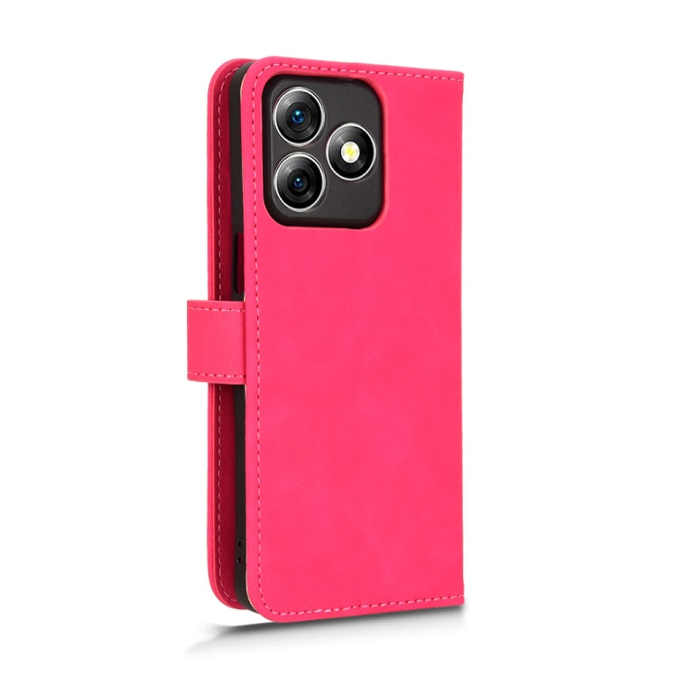 For Ulefone Note 18 Ultra Skin Feel Magnetic Flip Leather Phone Case(Rose Red) - Ulefone Cases by PMC Jewellery | Online Shopping South Africa | PMC Jewellery | Buy Now Pay Later Mobicred