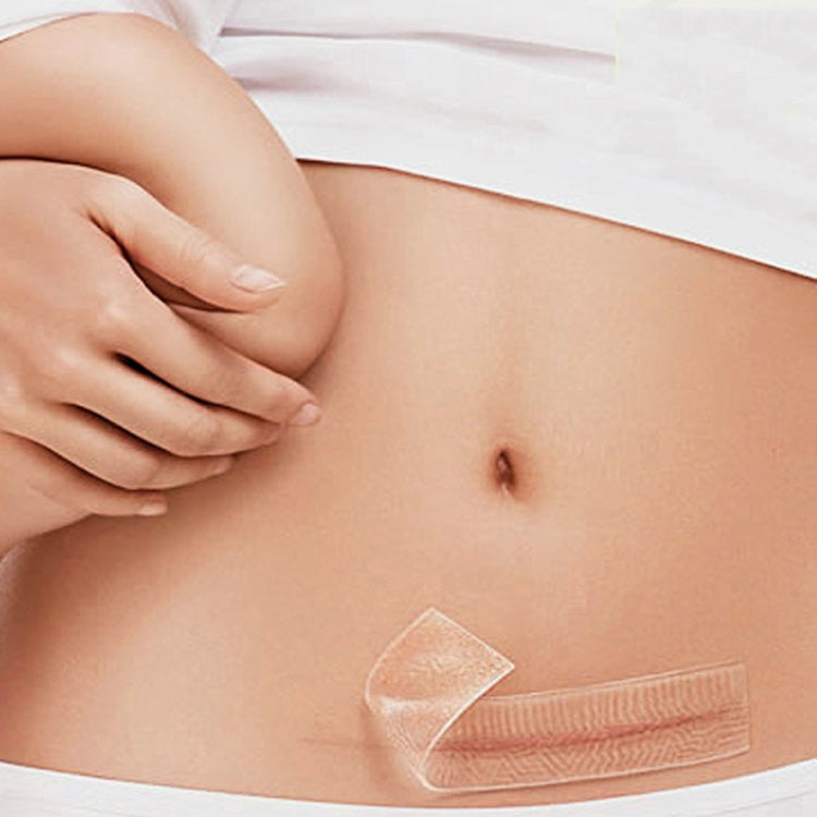 Organic silicone Gel Scar Therapy Patch  be Washed and Reused - free shipping - PMC TechLife - Order now!