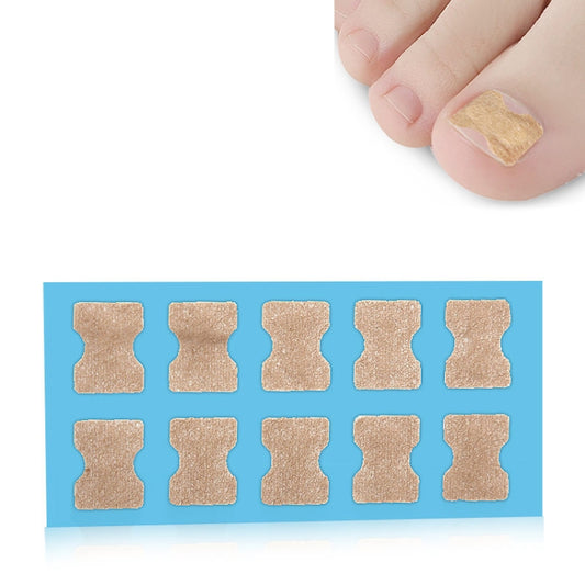 10 PCS Glue-free Orthopedic Nail Stick Toe Nail Groove Inlay Corrector(Blue Bottom) - Corrector by PMC Jewellery | Online Shopping South Africa | PMC Jewellery